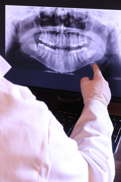 Best Dentist for Tooth Abscess  in Benton, KY