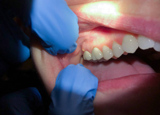 Best Emergency Gum Pain Relief  in Benton, KY