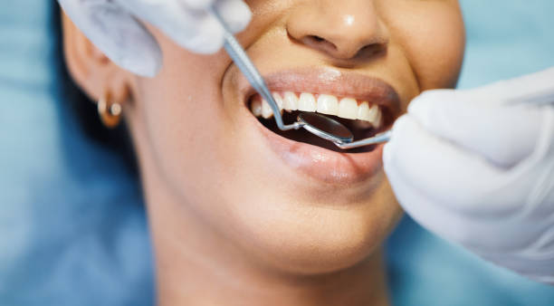 Best Urgent Tooth Repair  in Benton, KY